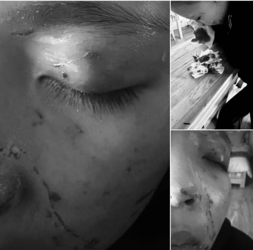 ЦЕГ: Архангай аймгийн Хайрхан сумын ЕБС-ийн 9, 11 ангийн сурагчид үл ойлголцсноос болж хоорондоо маргалдаж, нэгнийхээ биед гэмтэл учруулжээ