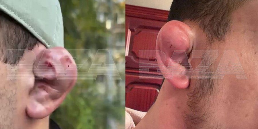 Эрчүүд MMA тамирчин шиг харагдахын тулд зориуд “цэцэгт байцаан чих” хийлгэдэг болжээ