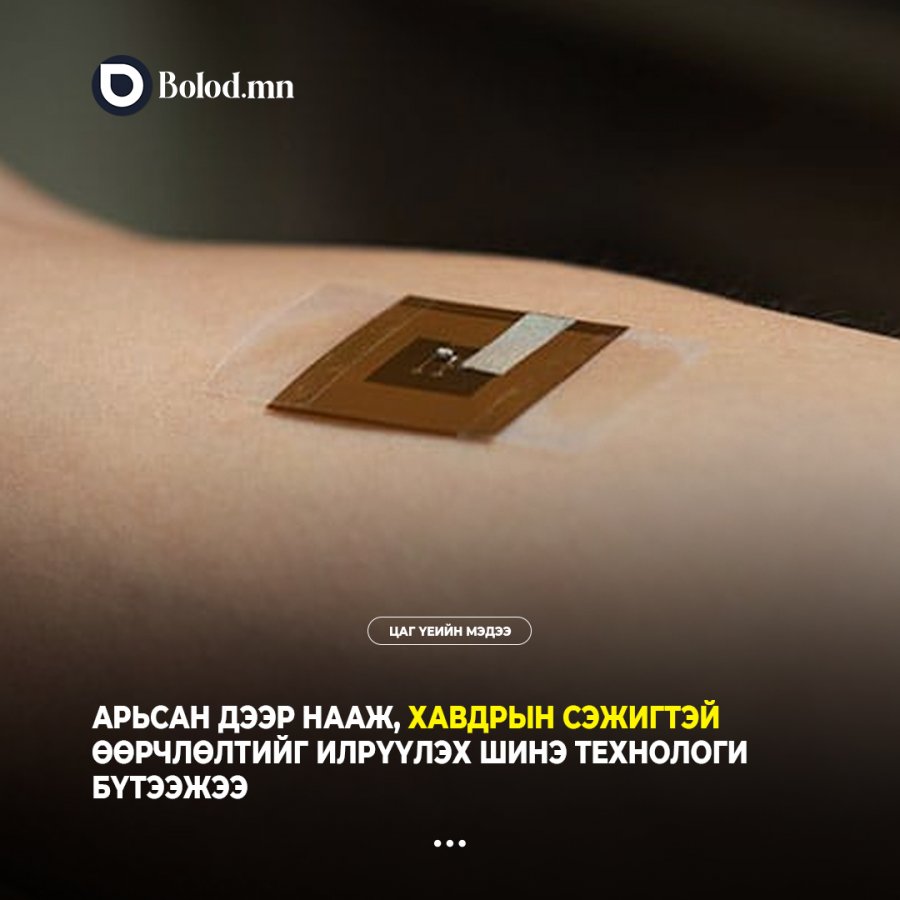 Арьсан дээр нааж, хавдрын сэжигтэй өөрчлөлтийг илрүүлэх шинэ технологи бүтээжээ