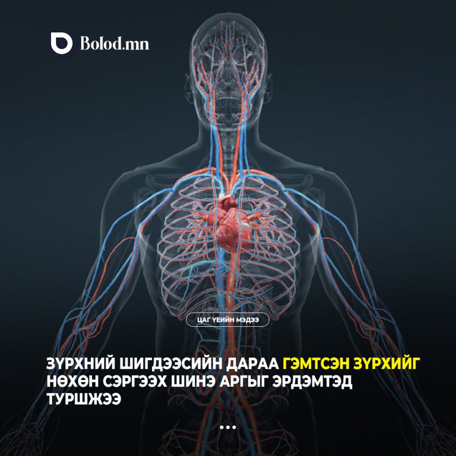 Зүрхний шигдээсийн дараа гэмтсэн зүрхийг нөхөн сэргээх шинэ аргыг эрдэмтэд туршжээ